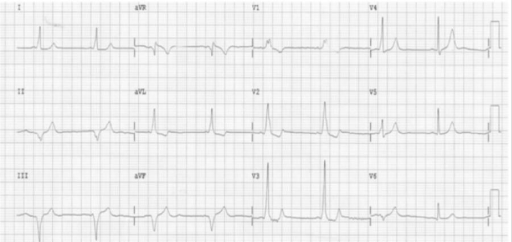 avm-aid1010-g004